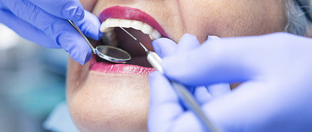 Best Emergency Broken Tooth Repair in Spencerport, NY